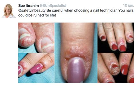 are fake gel nails toxic